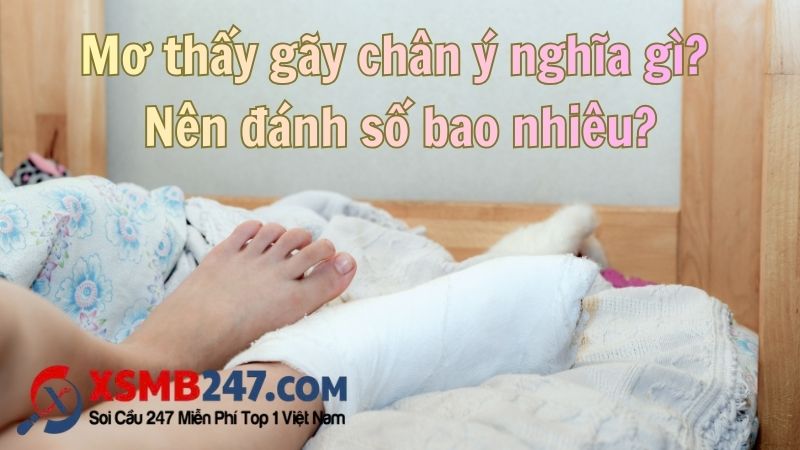 Nhiều ý nghĩa khi chiêm bao thấy gãy chân